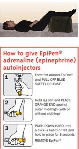 how to give epipen