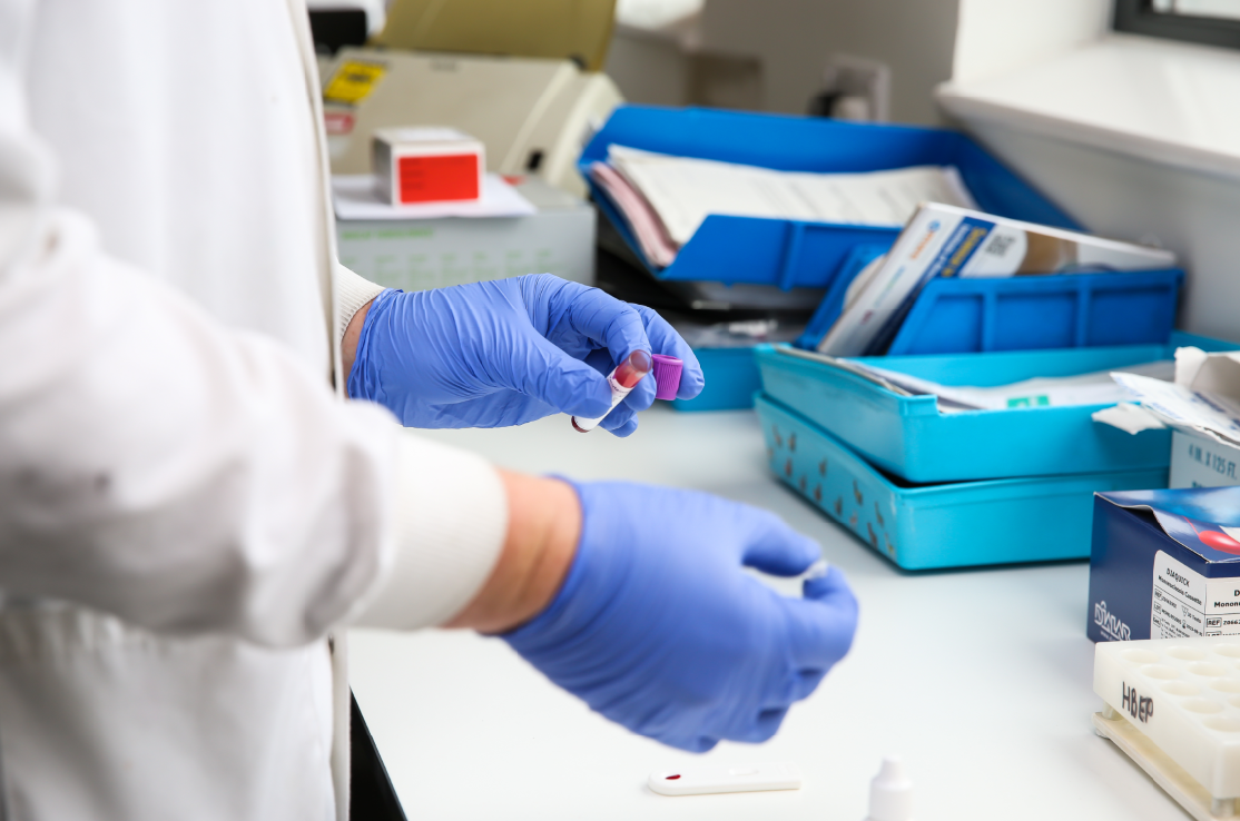 Pathology lab trays and rubber gloves