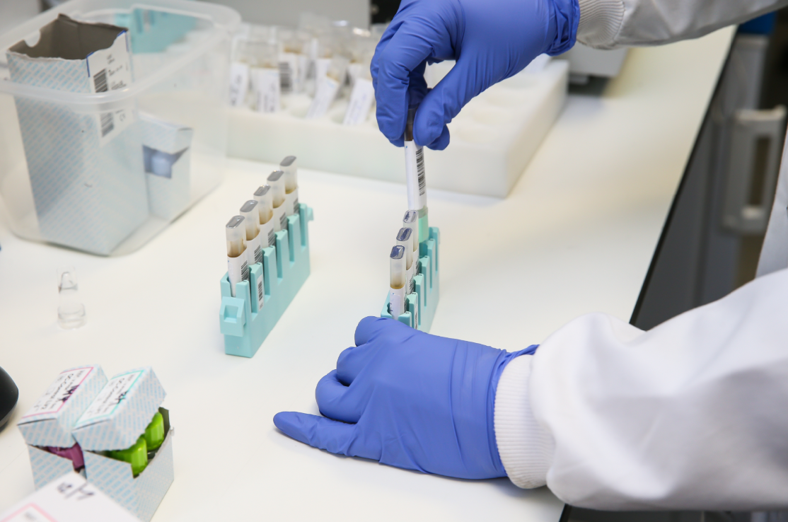 Pathology lab test tubes